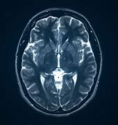 Image result for Detailed MRI Scan