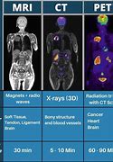 Image result for What Is Pet Scan