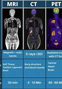 Image result for Pet MRI Scan