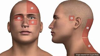 Image result for Headache Left Side of Head