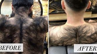 Image result for Hair On Back