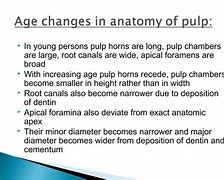 Image result for Pulp Anatomy