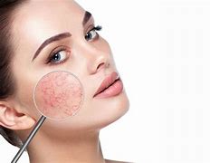 Image result for Trim Skin Lesion