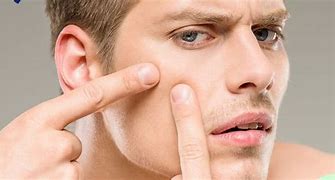 Image result for Pop Pimple Popping