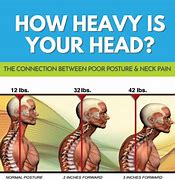 Image result for Head and Neck Posture