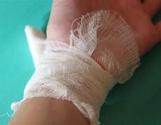 Image result for A Broken Bone