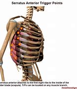 Image result for Serratus Anterior Referred Pain