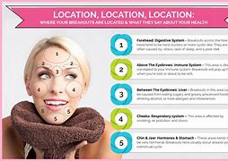 Image result for Pustules On Forehead