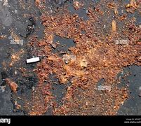 Image result for Coffee Ground Hematemesis