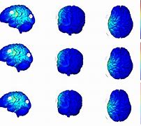 Image result for tDCS Placement Map