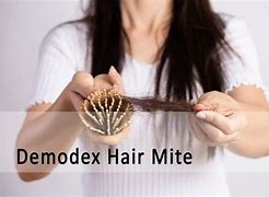 Image result for Demodex Mites On Scalp