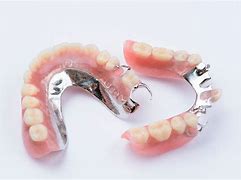 Image result for Metal-Based Partial Dentures