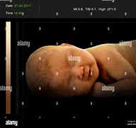 Image result for 5D Scan Baby Samsung