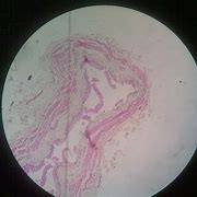 Image result for Ureter Blood Supply