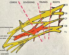 Image result for Brachial Plexus Roots