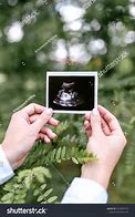 Image result for Baby Ultrasound Photo