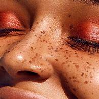 Image result for Interesting Faces Freckles