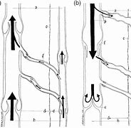 Image result for Nonphasic Venous Flow