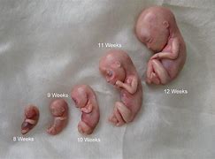 Image result for Embryo at 15 Weeks