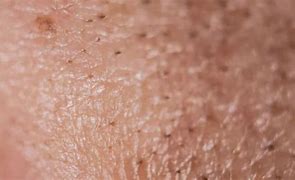 Image result for Macro Skin Pores