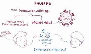 Image result for Mumps Drawing