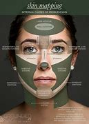 Image result for Acne Boy Face Map