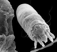 Image result for Eriophyid Tiliae Mite