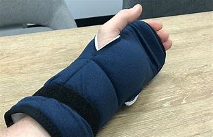 Image result for Carpal Tunnel Syndrome Brace