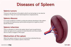 Image result for Spleen Disease Symptoms