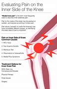 Image result for Left Side Knee Pain