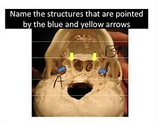 Image result for Pterygoid Plate