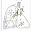 Image result for Lung Cancer On CT