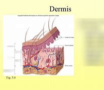 Image result for Skin Laceration Down to the Dermis