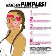 Image result for How to Prevent Pimples On Face