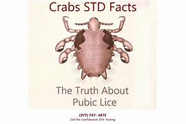 Image result for Crabs Infection