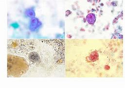 Image result for Intestinal Protozoa