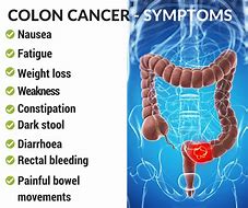 Image result for Colon Cancer Early Symptoms