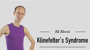 Image result for Klinefelter's Syndrome