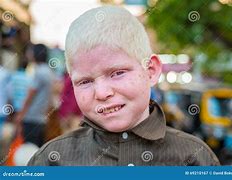 Image result for Albino Cricket