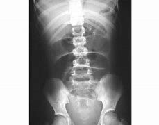 Image result for IRM Abdominal