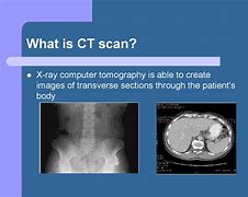 Image result for CT Scan Image for PPT