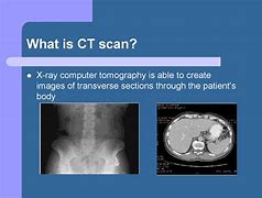 Image result for MSAD in CT PPT