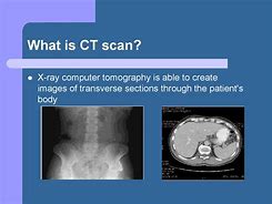 Image result for CT Scan Image Quality Lecture Ppt