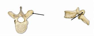 Image result for Dorsal Vertebrae