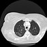 Image result for CT Scan Views