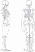 Image result for Plumb Line On Human Body