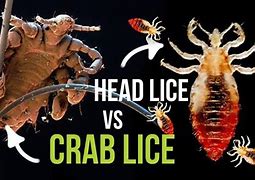 Image result for What Does Crabs Look Like On Skin