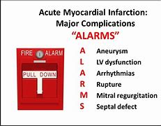 Image result for EMS Mnemonics