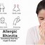 Image result for Allergy Journal