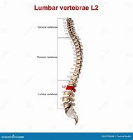 Image result for L5 Lumbar Vertebrae